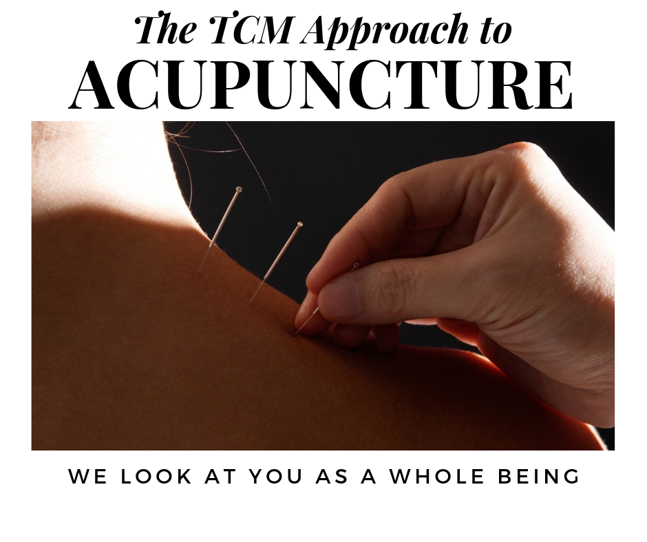 acupuncture whole being