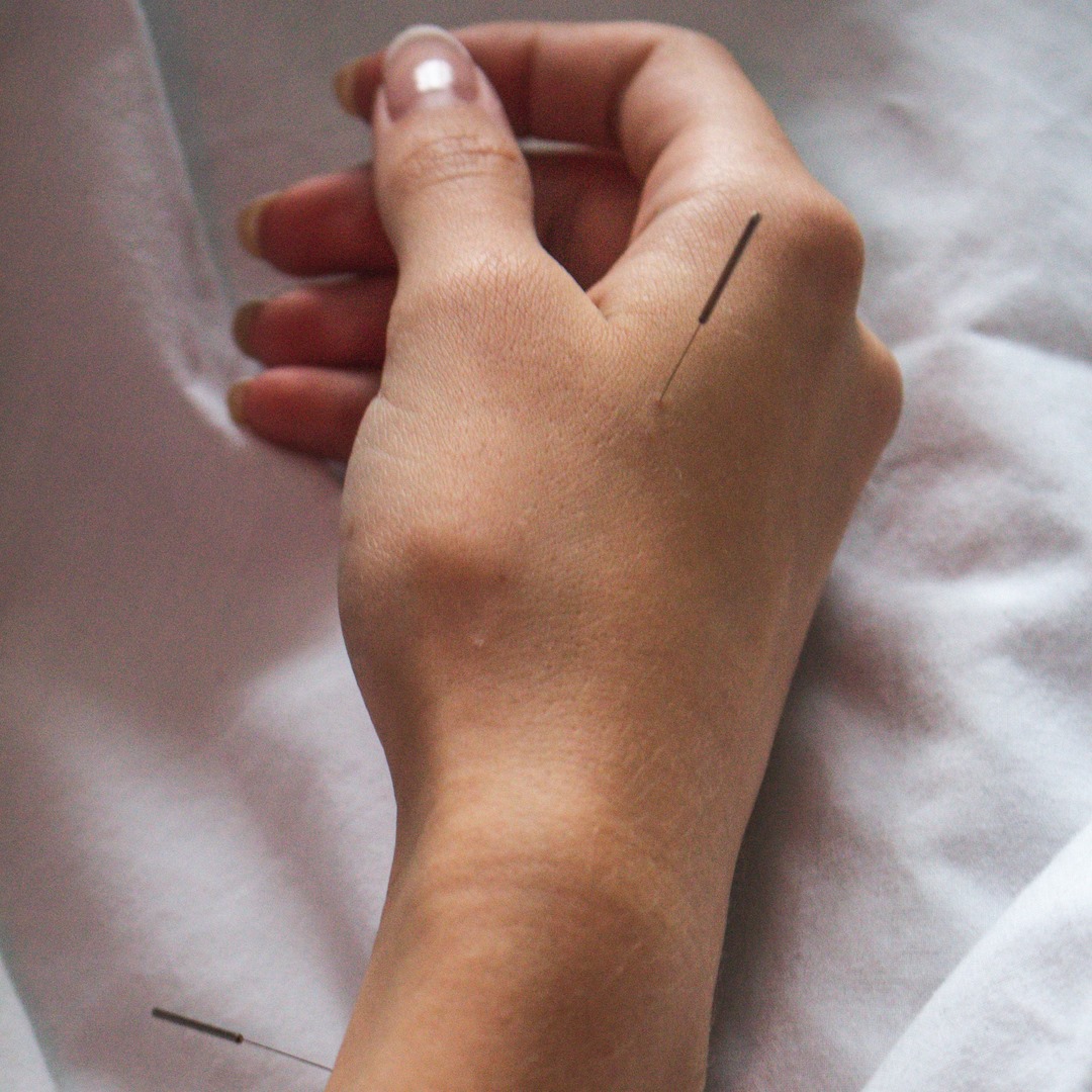 Sonja Denelzen R.Ac Licensed Acupuncturist Gravenhurst, Huntsville